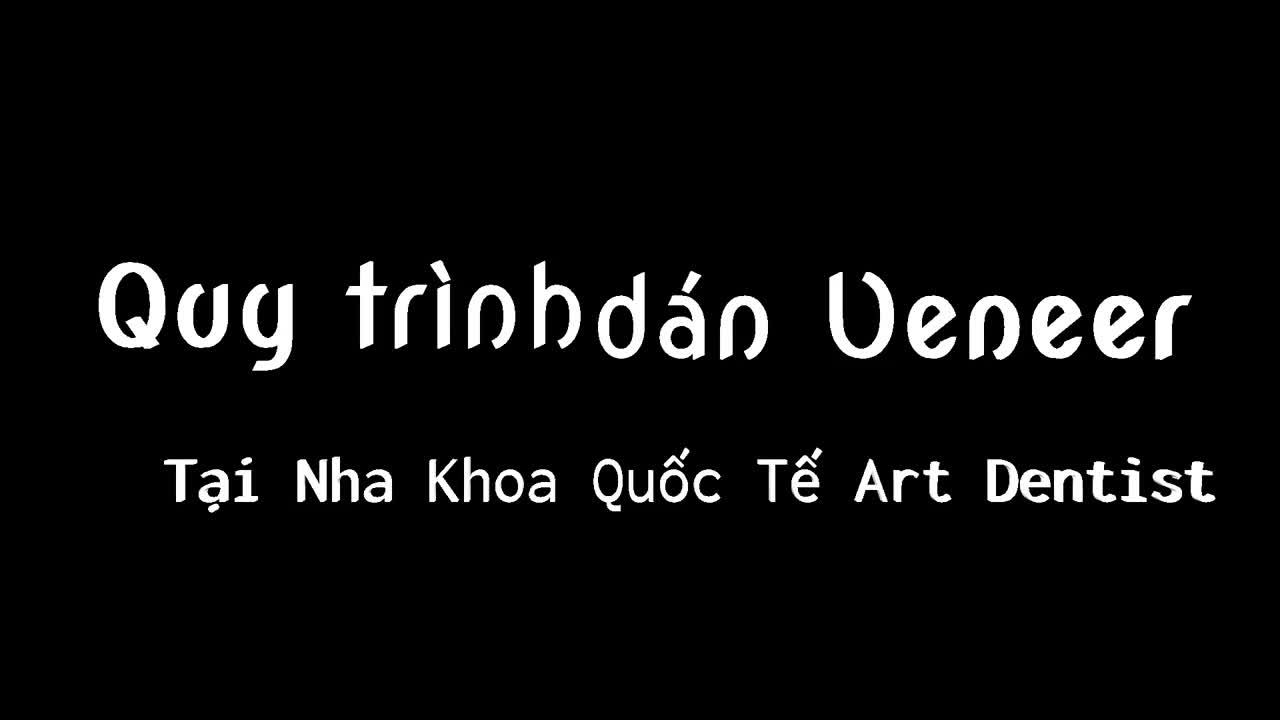 Dán sứ Veneer
Chọn Art Dentist