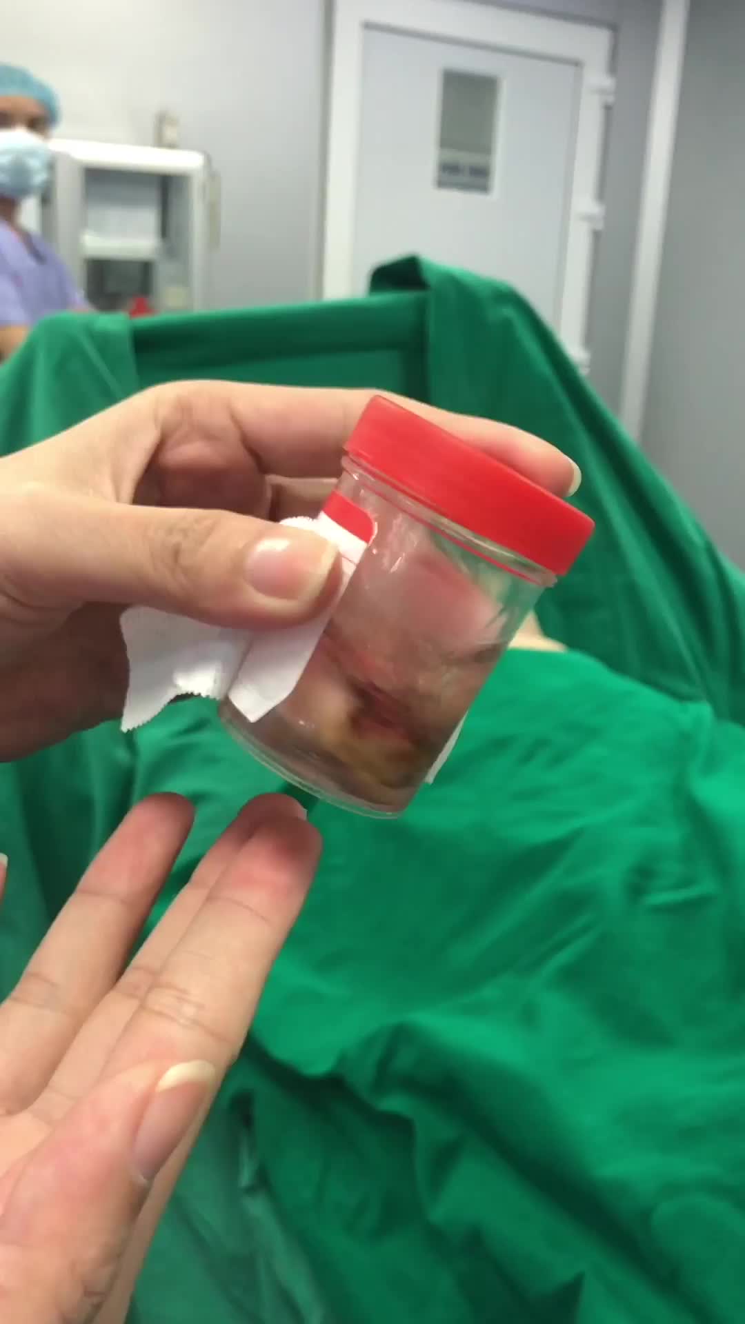 CÓ U SƠ LIỆU NÂNG NGỰC ĐƯỢC KHÔNG?