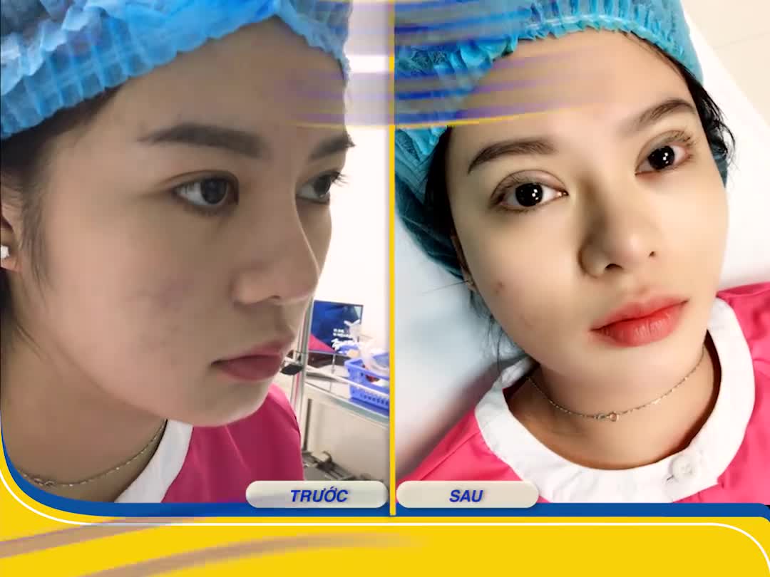 ĐẠI LỄ LÀM ĐẸP - NHẬN ƯU ĐÃI VÀNG