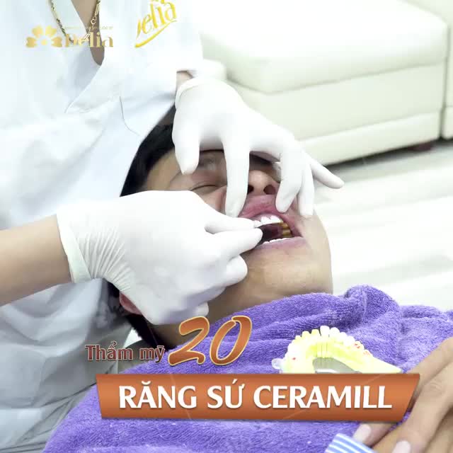 PHA BIẾN ĐỔI NGOẠN MỤC CỦA NAM KHÁCH HÀNG SAU THẨM MỸ RĂNG SỨ