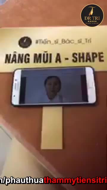 Kết quả sau phẫu thuật mũi A shape 1 tuần!