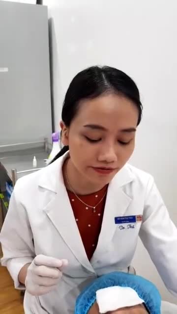 KHÁCH HÀNG ĐIỀU TRỊ BAN VÀNG BẰNG CÔNG NGHỆ LASER CO2 VI ĐIỂM