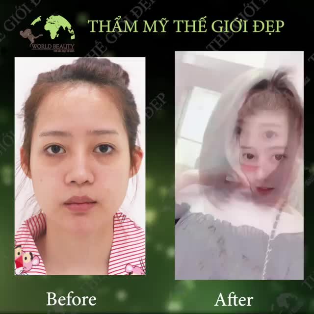 Mỗi ngày một MÓN_QUÀ thật đặc biệt từ quý Khách Hàng dành cho Bác sĩ và đội ngũ nhân viên tại Thế_Giới_Đẹp thêm cố gắng.