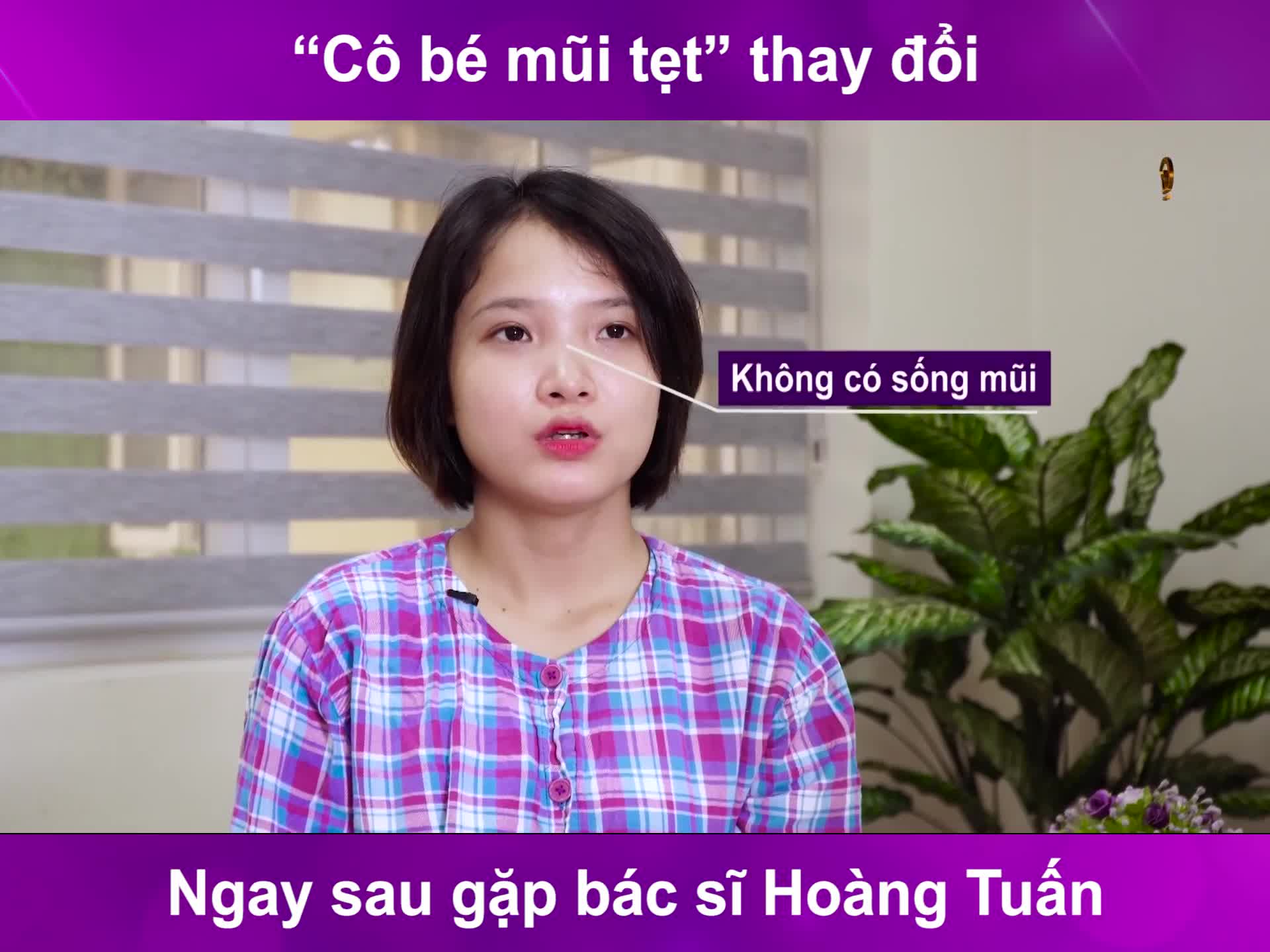 "Cô bé mũi tẹt" thay đổi ngay sau gặp bác sĩ Hoàng Tuấn