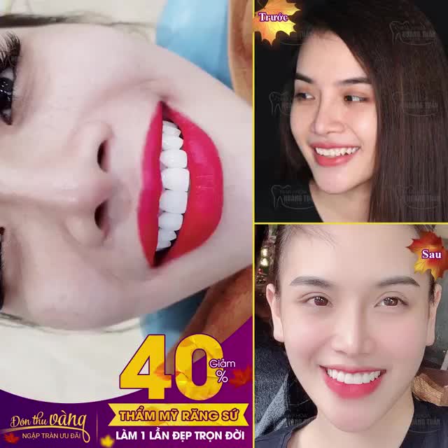 Nếu bạn muốn 1 nụ cười đẹp vĩnh viễn với thời gian hãy đến Nha khoa Hoàng Tuấn