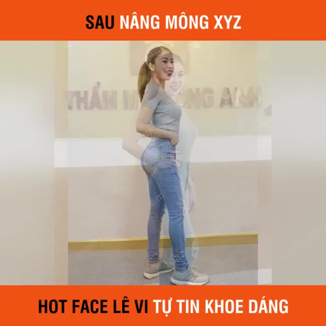 Sau khi được Đội ngũ Y Bác sĩ của Thẩm Mỹ Hồng Anh Nâ.ng m.ông XYZ. Lê Vi đã hữu v.òng 3 s.e.x.y, căng tròn, đầy đặn, mềm mại như hiện nay.