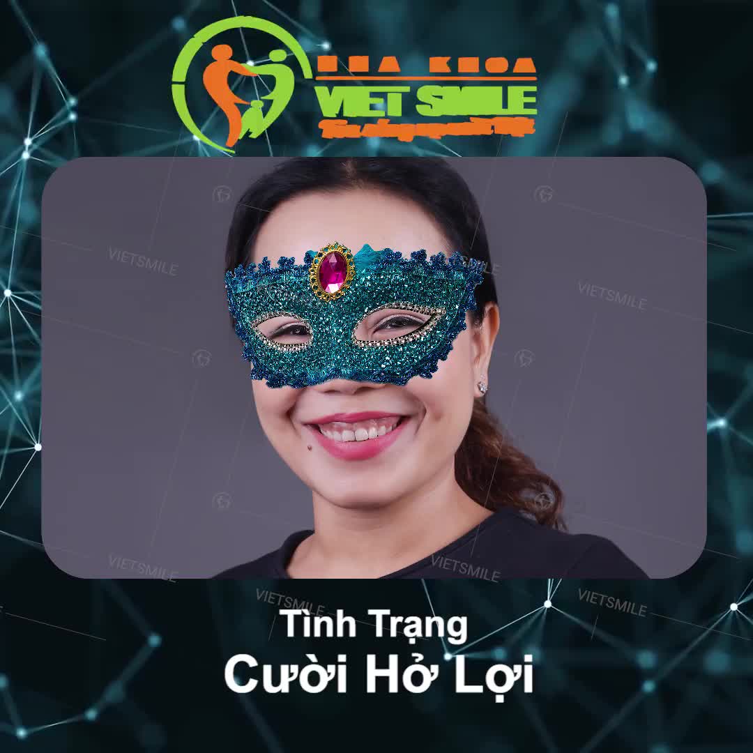 ĐIỀU TRỊ CƯỜI HỞ LỢI LẦN DUY NHẤT - ĐẸP MÃI VỀ SAU