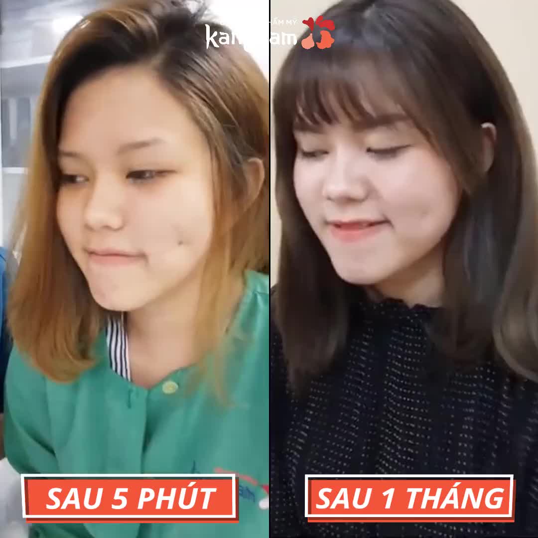 Sau 5 PHÚT ? Má lúm RÕ NÉT