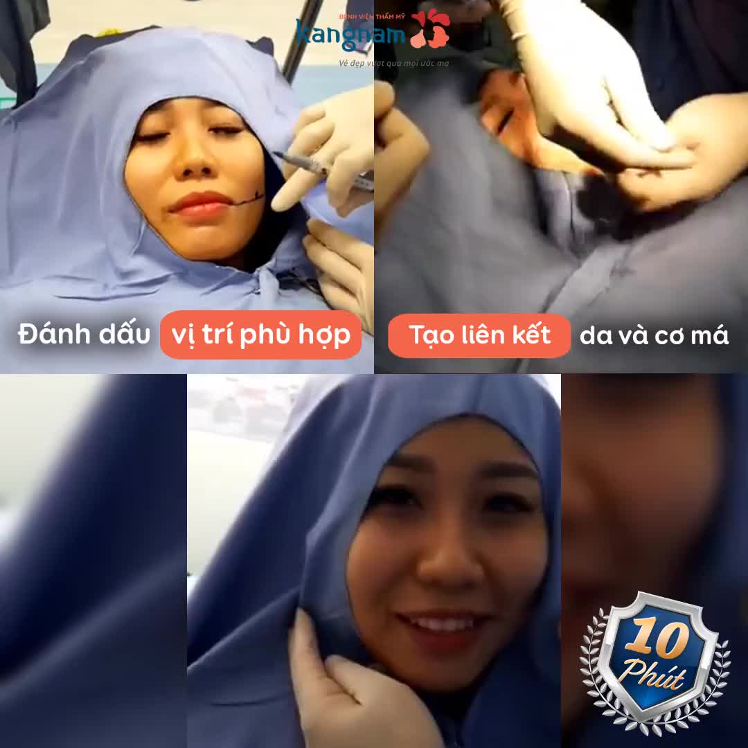Tạo má lúm Cutie | Làm là đẹp, cười duyên hết ý!