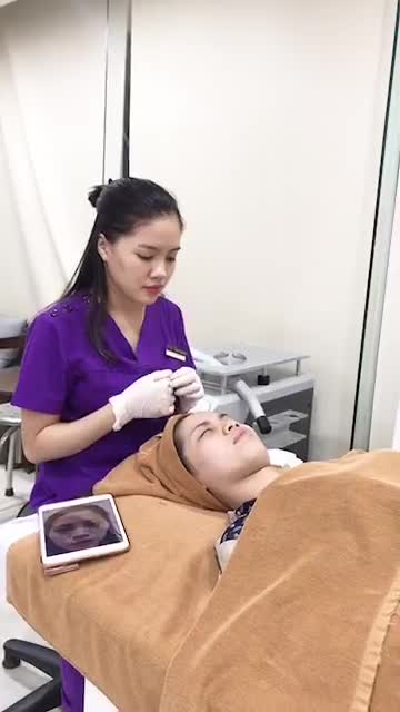 Cải thiện 50% tình trạng sẹo rỗ chỉ sau 2 buổi điều trị với công nghệ Laser AcuPlse