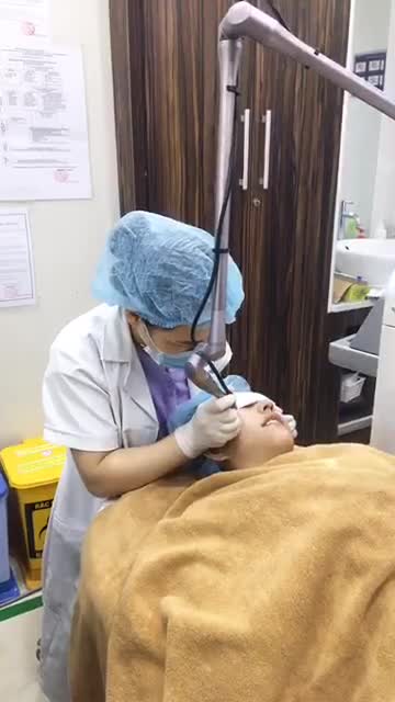 Sẹo lõm, rỗ CẢI THIỆN 80% | Kết quả sau buổi điều trị thứ 2