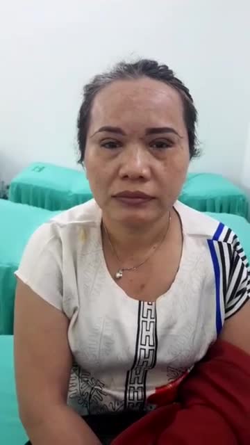 Trực tiếp ca phẫu thuật treo mày bấm mí cho vị khách hàng 53 tuổi Giúp khách hàng trẻ hơn so với độ tuổi thực tế của mình