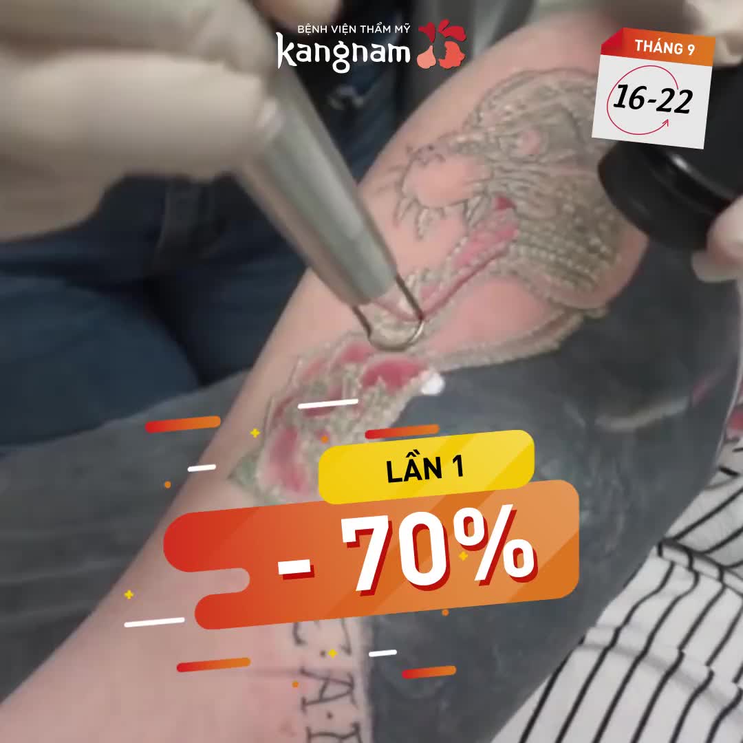 [16 - 22/09] TUẦN VÀNG XÓA XĂM - Siêu ưu đãi giảm tới 70%