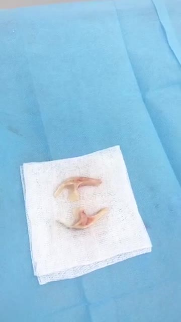 HẠ GÒ MÁ