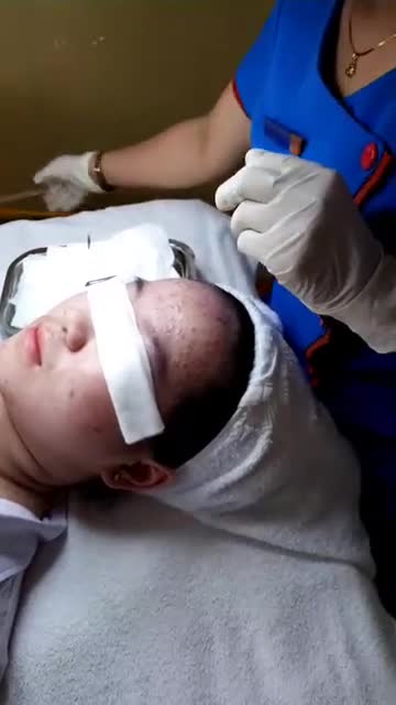 MỤN Ư CHUYỆN NHỎ ĐÃ CÓ KANGNAM LO