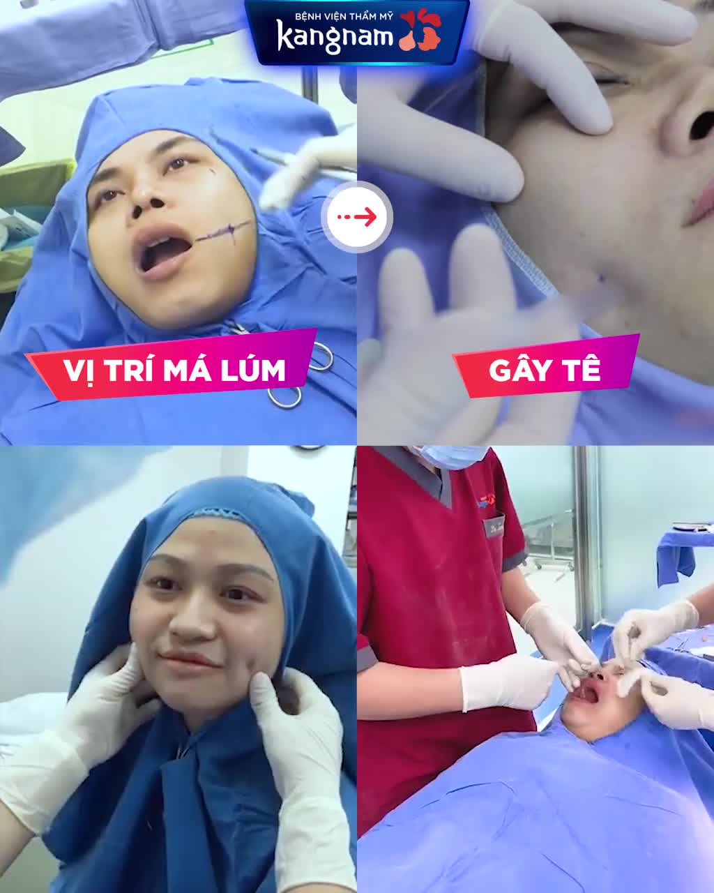 Chỉ 5 PHÚT  Có ngay MÁ LÚM DUYÊN XINH như ý