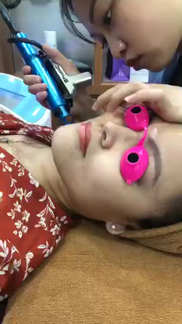 Sau liệu trình điều trị tàn nhang, chị Hạnh tiếp tục tin tưởng Dr Hoàng Tuấn và sử dùng thêm dịch vụ điều trị gian Mao mạch