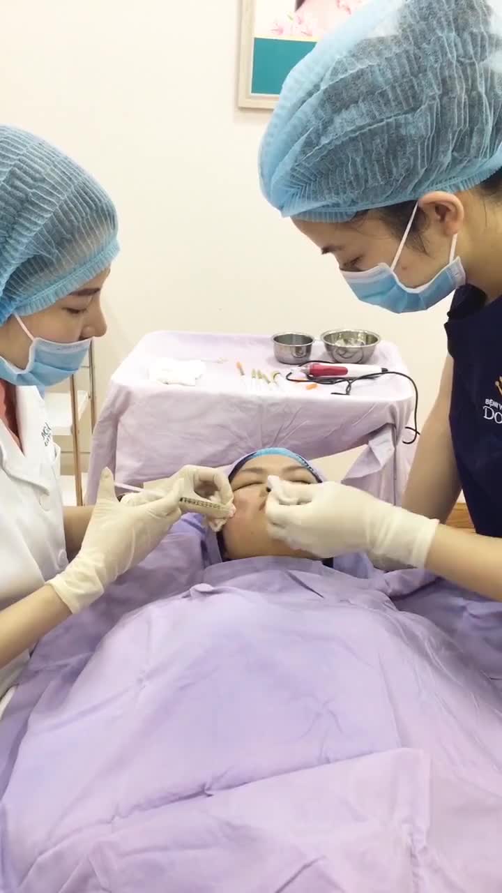 Tưởng vô phương cứu chữa" với SẸO LÕM KH thay đổi bất ngờ sau 2 lần điều trị sẹo BIOSCAR