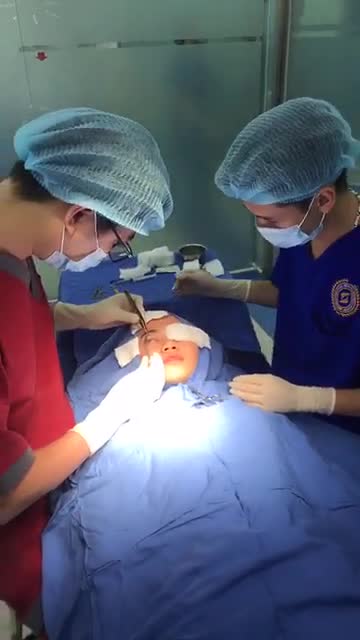Bấm mí Multi-Point - Chỉ 30 PHÚT hô biến mắt đẹp