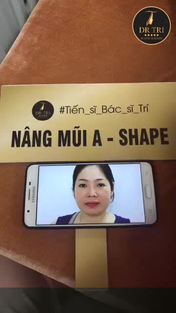 NÂNG MŨI A SHAPE