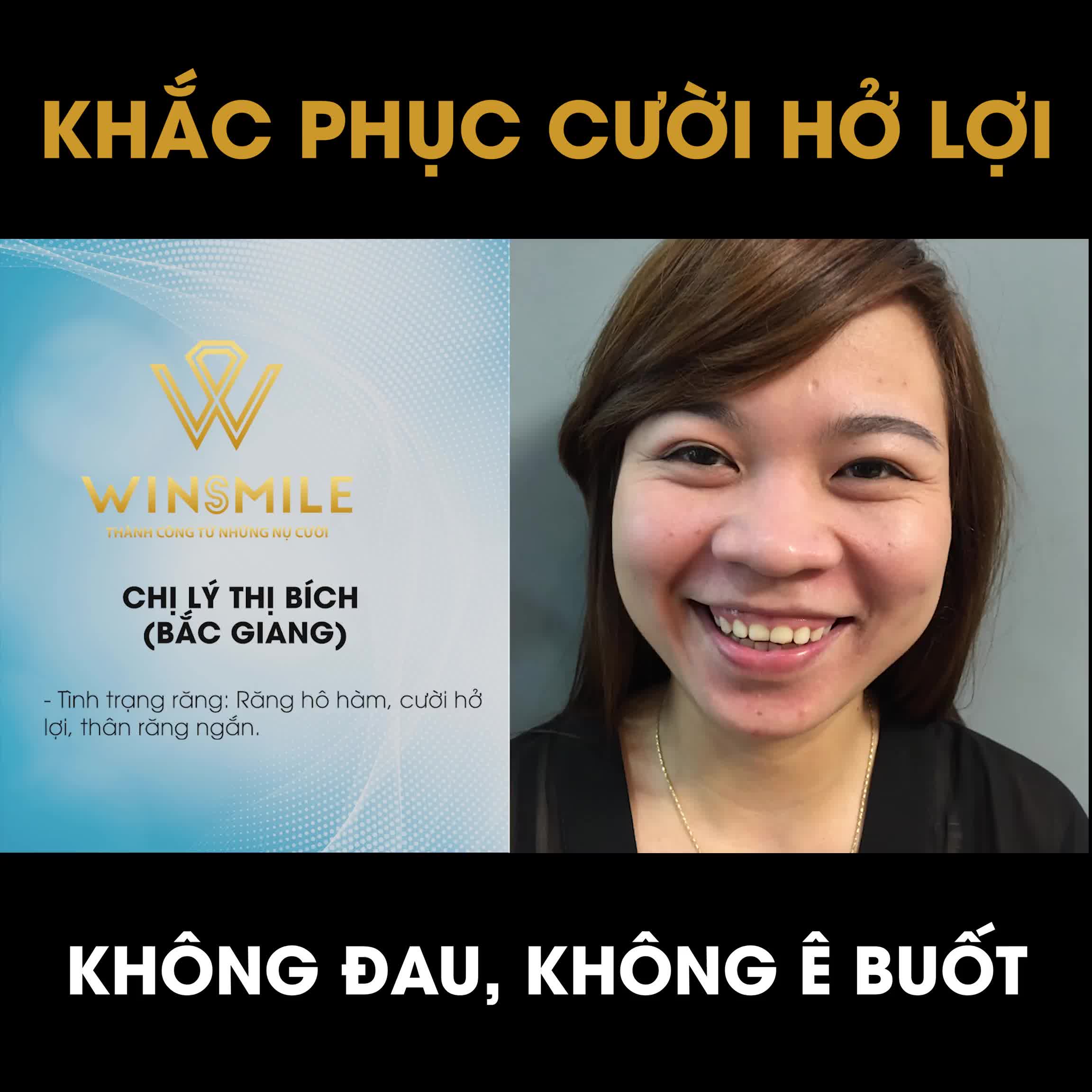 PHẪU THUẬT HÀM HÔ, KÉO DÀI THÂN RĂNG CHỮA CƯỜI HỞ LỢI!