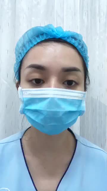 Hàm vẩu, cười hở lợi sống chung gần 40 năm và mong muốn cải thiện khuôn mặt của chị khách hàng.