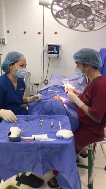 Quá trình đo vẽ TẠO HÌNH MÔI tại Kangnam
