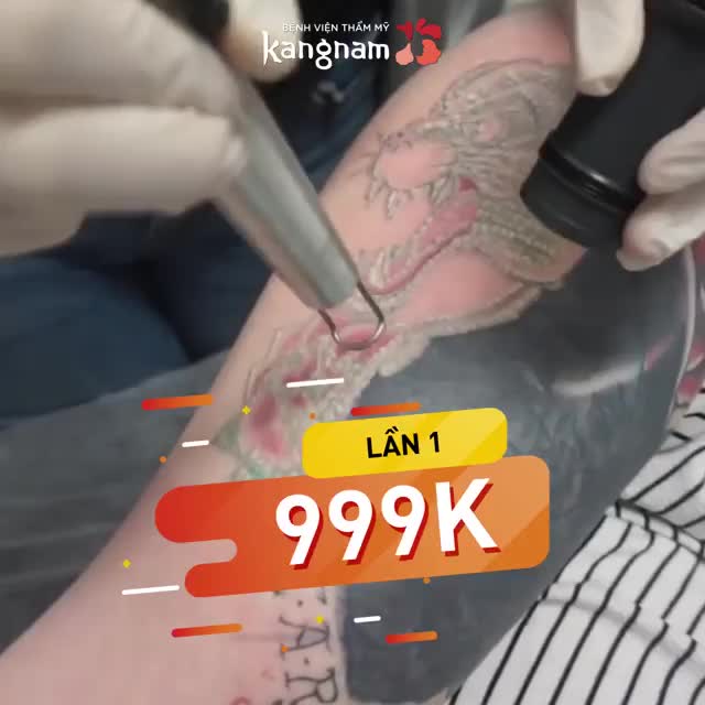 TUẦN VÀNG XÓA XĂM- INBOX nhận giá xóa xăm tốt nhất