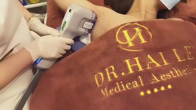 CÙNG XEM QUY TRÌNH ĐIỀU TRỊ CHỨNG TĂNG TIẾT MỒ HÔI NÁCH DOUBLE MIRADRY