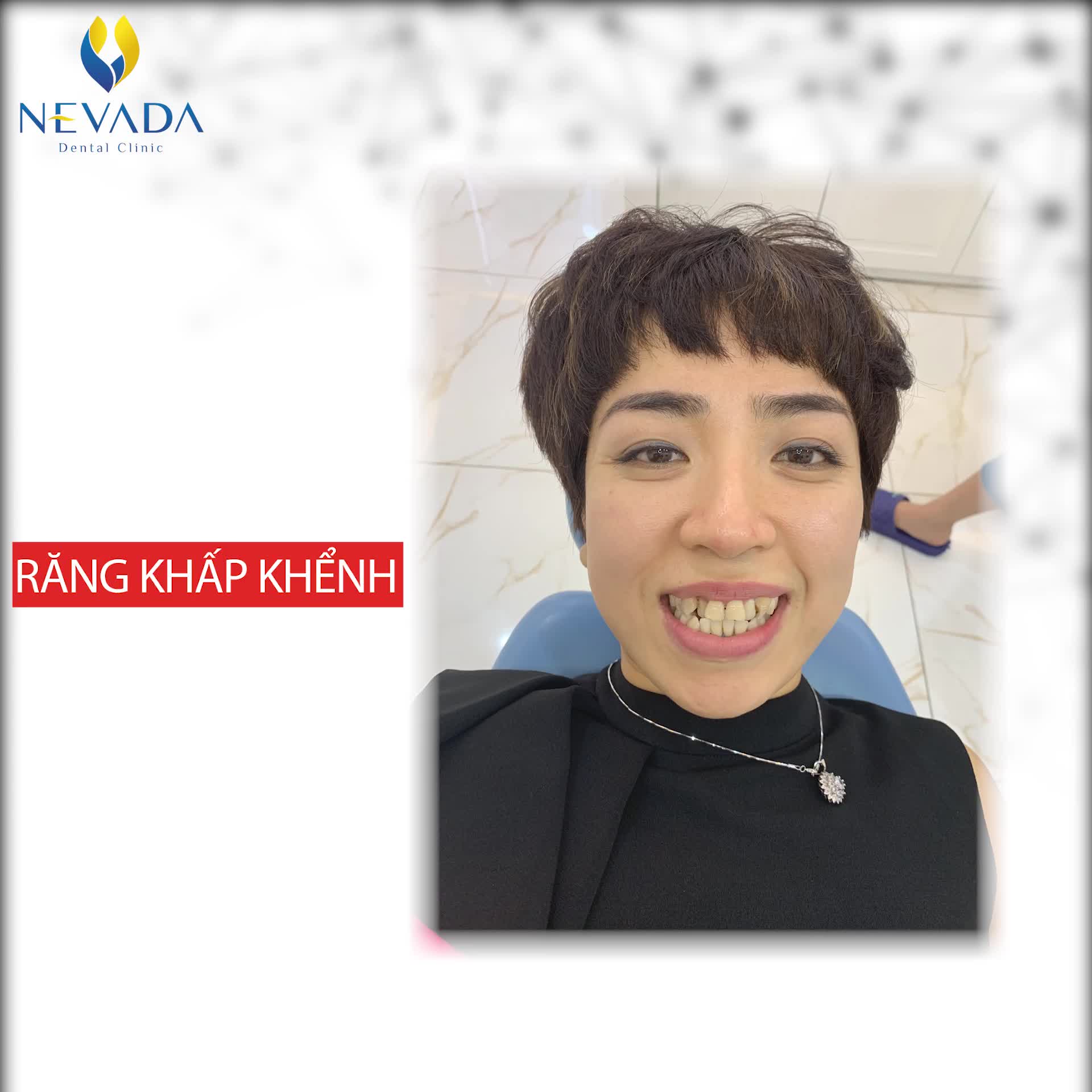 ĐIỀU GÌ KHIẾN BẠN CHƯA TỰ TIN CƯỜI?