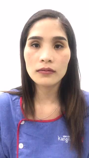 Kết quả môi tim KH ngay sau phẫu thuật!