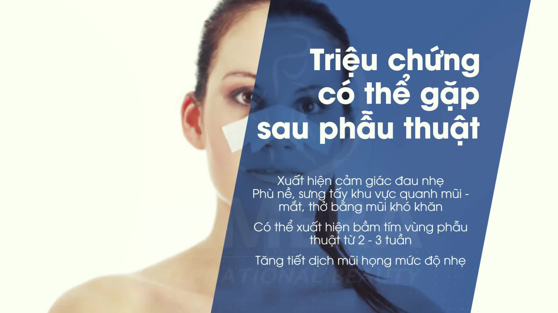 HƯỚNG DẪN CHĂM SÓC ĐÚNG CÁCH SAU NÂNG MŨI