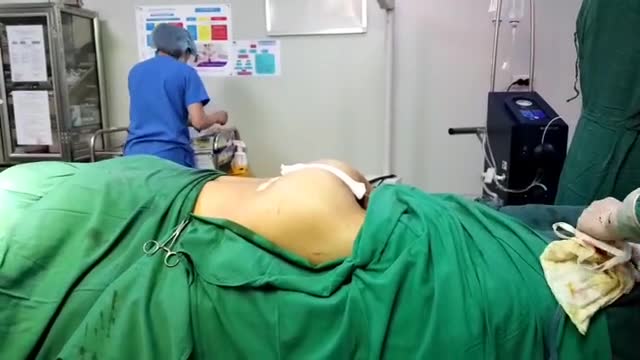 HÚT MỠ BỤNG + EO BẰNG CÔNG NGHỆ HÀNG ĐẦU THẾ GIỚI BODY JET VÀ NÂNG CẤP VÒNG 3