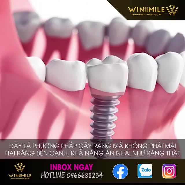 MẤT RĂNG KHÔNG CÒN LÀ NỖI LO!