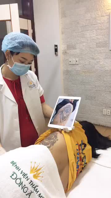 Quá trình xoá xăm