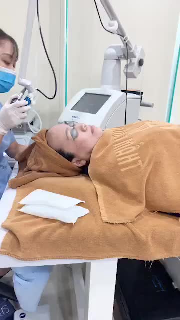 Cận cảnh 1b điều trị Sẹo Rỗ do mụn viêm để lại với laser Ultrapulse !