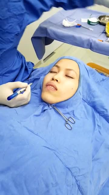KH làm combo thu mỏng môi trên + độn cằm mỹ