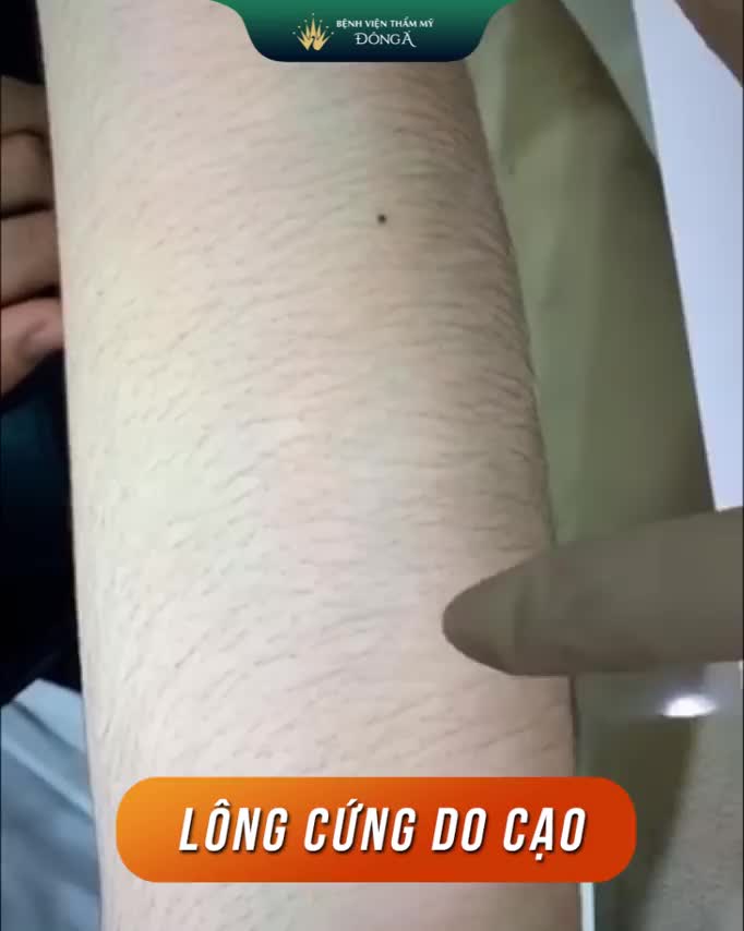 Lông rậm như CỎ khiến cánh mày râu "hết hồn" trước cánh tay của chị em