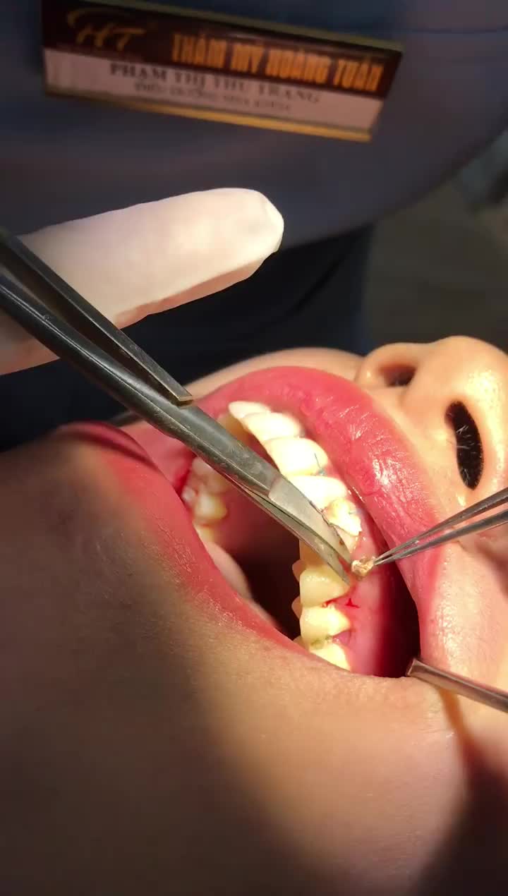Tổng kết Nha khoa Hoàng Tuấn ngày 9/12/2019