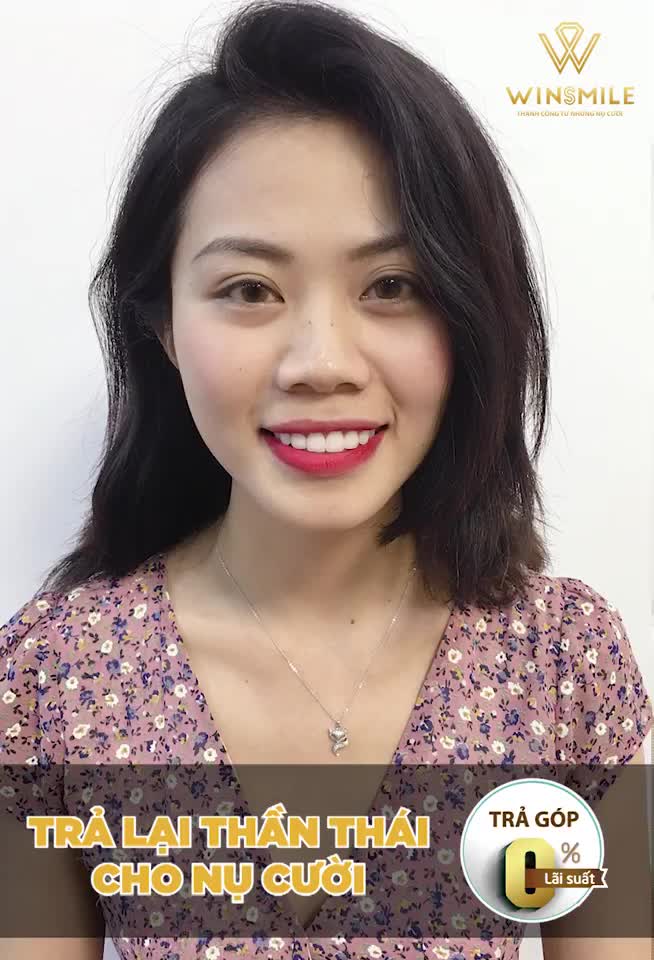 TRẢ LẠI THẦN THÁI CHO NỤ CƯỜI NHƯ THẾ NÀO?