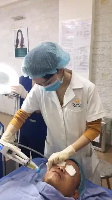 Quá trình điều trị sẹo lõm Bio Scar