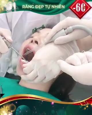 RĂNG ĐẸP LUNG LINH CƯỜI XINH ĐÓN TẾT OFF ~60%- Chỉ từ 1.5 TR