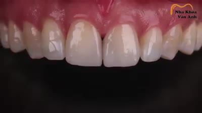 Nụ cười đẹp - lôi cuốn giúp bạn nhiều cơ hội giao tiếp sự nghiệp thăng hoa