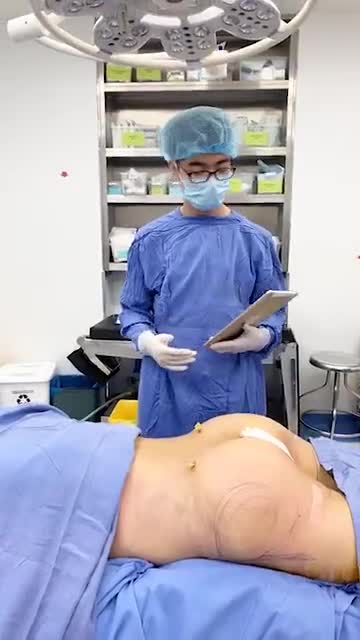 Kết quả CẤY MỠ hõm mông - Vòng 3 siêu CĂNG TRÀN