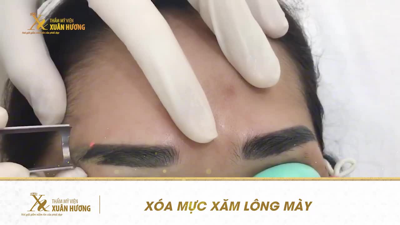 LÔNG MÀY XĂM HỎNG, LỖI MỐT, BỊ CHÊ "DỮ TƯỚNG"
