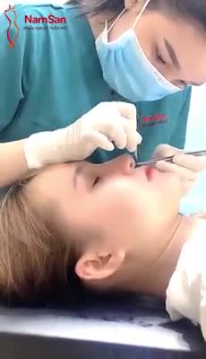 Chia tay năm cũ, NÂNG MŨI đón khởi đầu mới