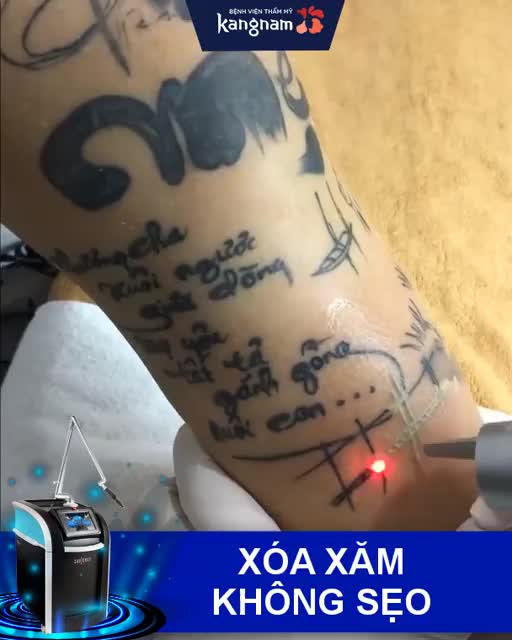Cận cảnh XÓA XĂM ĐẬM với LASER PICOSURE