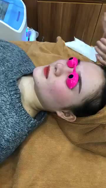 Cải thiện tình trạng giãn mao mạch với công nghệ laser Aileen.