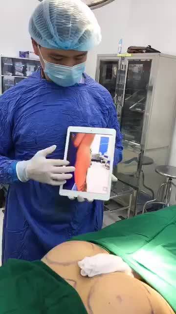 Tuyệt phẩm NÂNG MÔNG BIOFAT