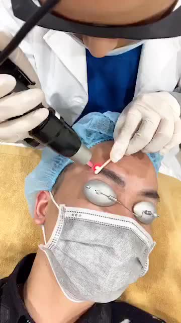 Tận mắt chứng kiến khả năng XÓA XĂM vượt trội của Laser Picosre